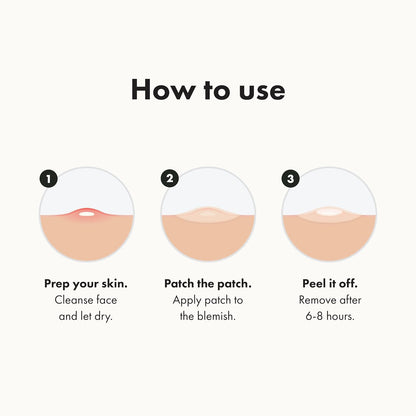 Hero Cosmetics Mighty Patch Original Acne Pimple Patches – Hydrocolloid Spot Treatment for Zits & Whiteheads, Overnight Face Patches, 36 Count