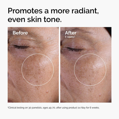 The Ordinary Glycolic Acid 7% Exfoliating Toner | Brightening & Smoothing Skincare