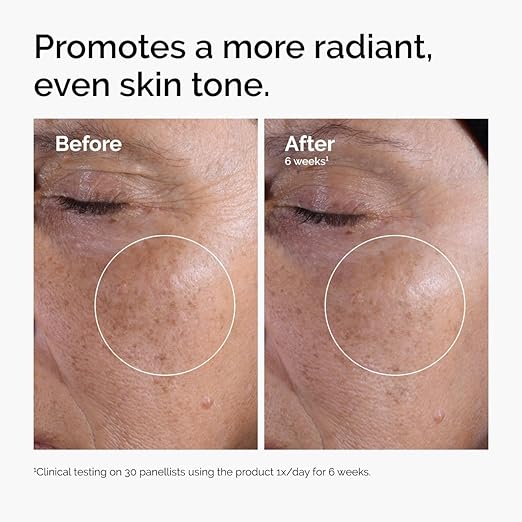 The Ordinary Glycolic Acid 7% Exfoliating Toner – Brightening & Smoothing Daily Toner for Even Skin Tone (240ml)